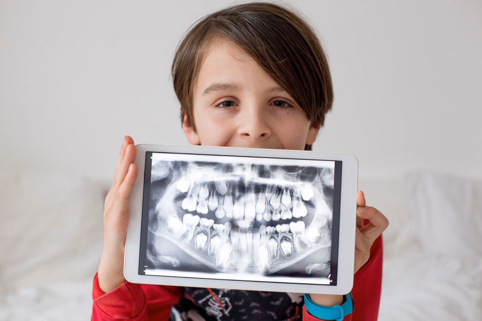 Dental X-rays